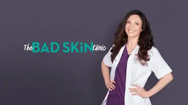 SOS Dermato L'impression d'être un monstre de foire