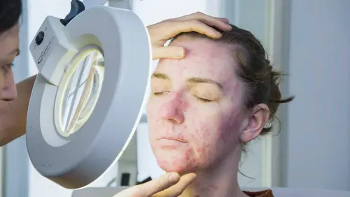 SOS Dermato Joze, Olivia, Millie & Florence