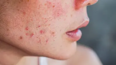 SOS Dermato C'est plus que ma peau