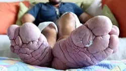 SOS pieds en détresse Chercher le pied