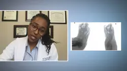 SOS pieds en détresse Chercher le pied