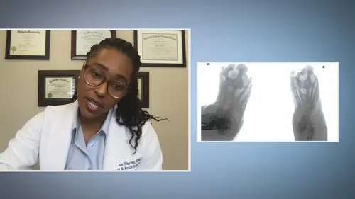 SOS pieds en détresse Chercher le pied