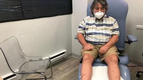 SOS : pieds en détresse Ongles macaroni