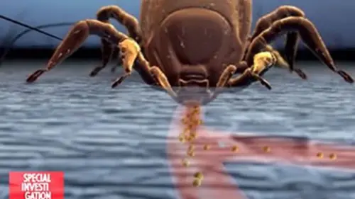 Spécial investigation Lyme : l'épidémie invisible