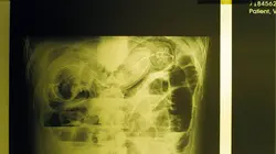 Sputnik : espèce inconnue