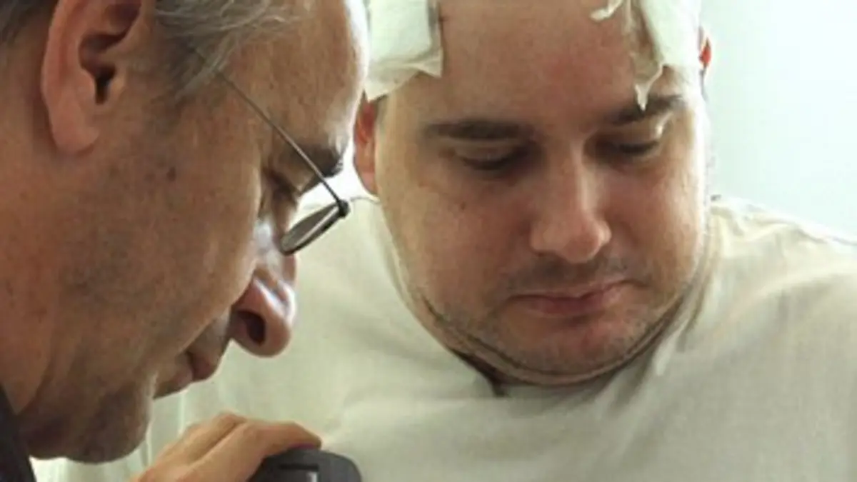 Stimulation cérébrale, un nouvel espoir pour les toc ?