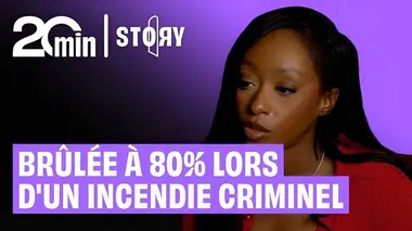 Grace, brûlée à 80% lors d'un incendie criminelle