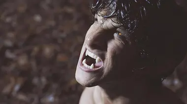 Teen Wolf S03E01 Plaies ouvertes
