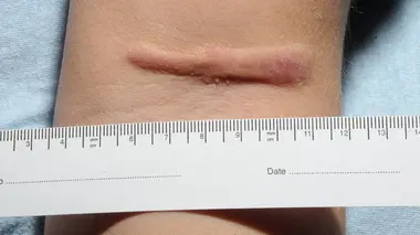 Tropiques et parasites