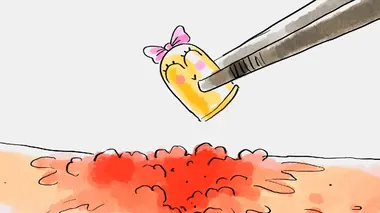 Blessures par balles, ça fait mal ?