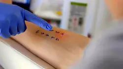 Un monde d'allergiques