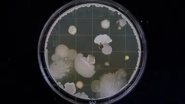 Un monde sans microbes