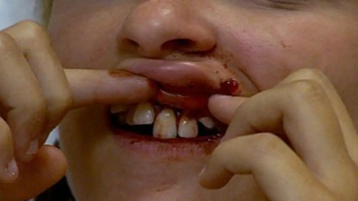 Urgences S01E01 Balles de golf