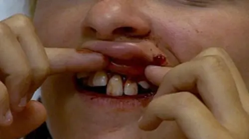 Urgences S01E01 Balles de golf