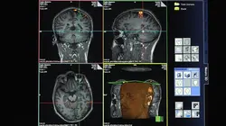 Voir le cerveau penser