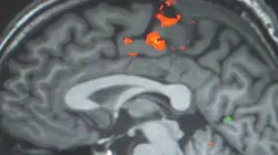 Voir le cerveau penser