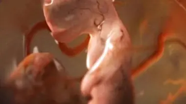 Créatures insolites