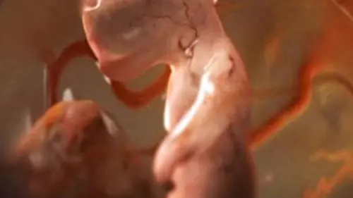 Épisodes de Voyage au centre de la vie