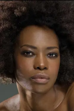 Photo Woodlene Alexis