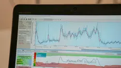 X:enius Les hormones : plus influentes que jamais